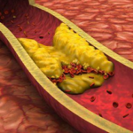 Tout ce qu’on doit savoir sur le cholestérol