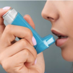 La prise en charge intégrative de l’asthme
