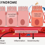 L’hyperperméabilité intestinale ou Leakey Gut syndrome ?